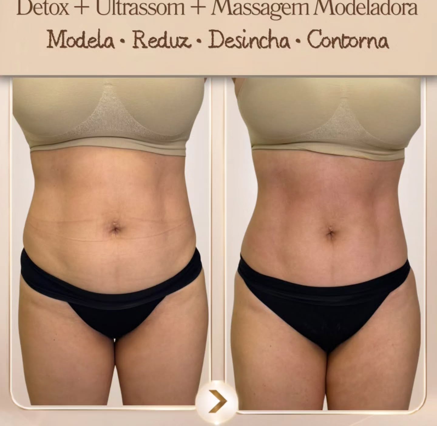 Detox, ultrassom e massagem modeladora